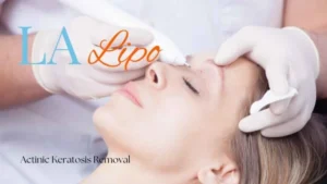 Woman receiving Actinic Keratosis Removal Treatment South Woodford