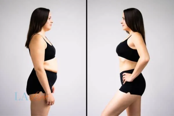 link between body image and mental health South Woodford
