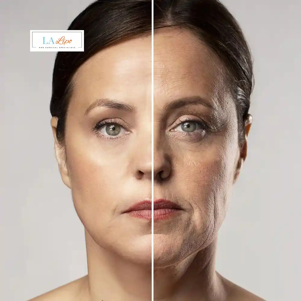 How Can You Tell If Non-Surgical Skin Tightening Is Right for You South Woodford?