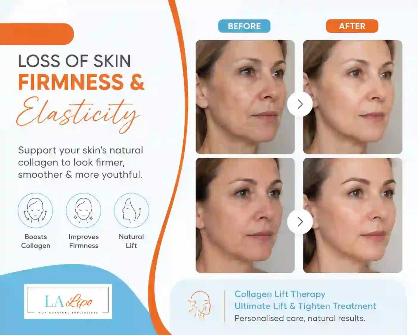 Sign #7: Loss of Skin Firmness and Elasticity South Woodford